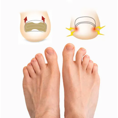 Combo 2x1 Premium Cuidado de Uñas - 🔥 OFERTA DEL DÍA 🔥